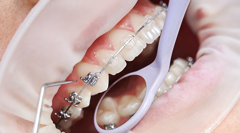 Evolução da Ortodontia